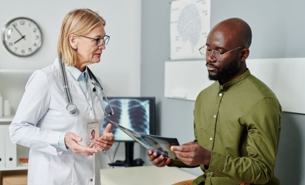 ¿Qué es un nódulo pulmonar y es cáncer?