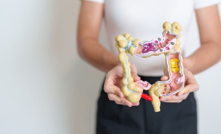 Pólipos de colon: ¿Son cancerosos?