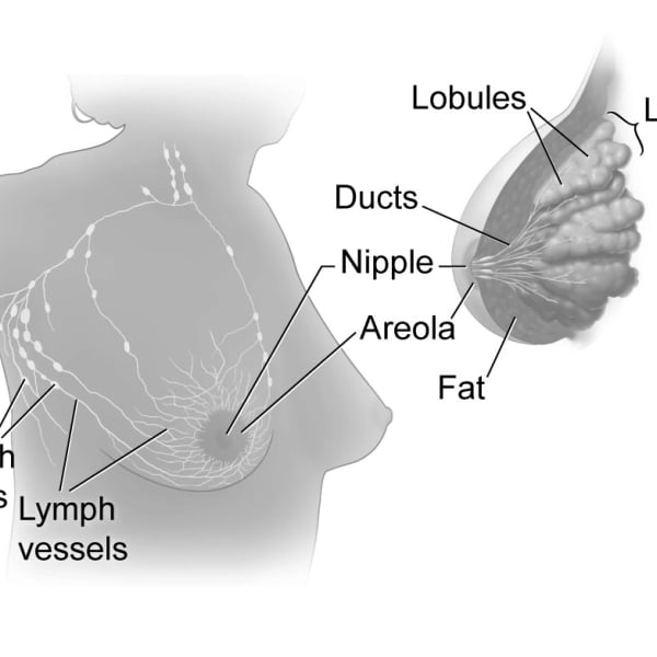 Ganglios linfáticos y cáncer de mama